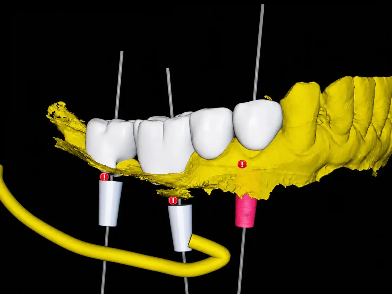 3D Dental Analysis